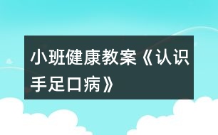 小班健康教案《認識手足口病》