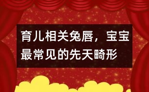 育兒相關：“兔唇”，寶寶最常見的先天畸形