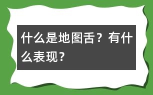 什么是地圖舌？有什么表現(xiàn)？