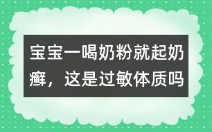 寶寶一喝奶粉就起奶癬，這是過敏體質嗎