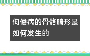 佝僂病的骨骼畸形是如何發(fā)生的