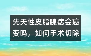 先天性皮脂腺痣會癌變嗎，如何手術(shù)切除