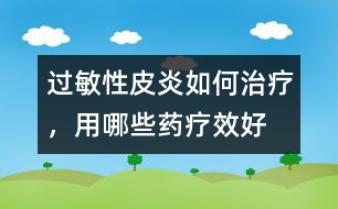 過敏性皮炎如何治療，用哪些藥療效好