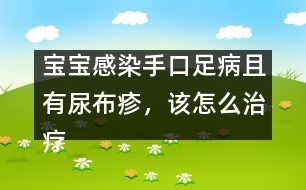 寶寶感染手口足病且有尿布疹，該怎么治療