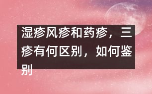 濕疹風(fēng)疹和藥疹，三疹有何區(qū)別，如何鑒別