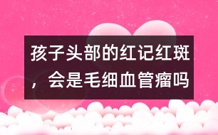 孩子頭部的紅記、紅斑，會是毛細血管瘤嗎