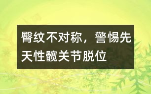 臀紋不對稱，警惕先天性髖關節(jié)脫位