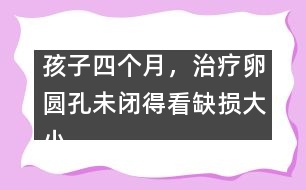 孩子四個(gè)月，治療卵圓孔未閉得看缺損大小