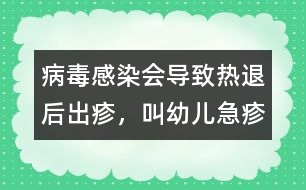 病毒感染會導(dǎo)致熱退后出疹，叫幼兒急疹